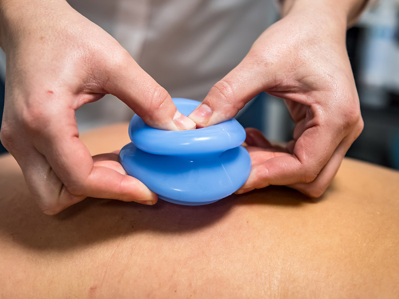 Kamila Pyś - rehabilitacja - masaż bańką chińską