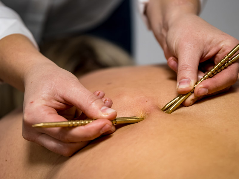 Kamila Pyś - rehabilitacja - mobilizacja blizn